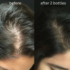 Herbal Hair Oil